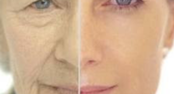 Kırışıklıklar için Maske Tarifleri